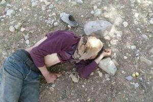 بالصور:مواجهة دامية بين رعاة وسكان ضواحي اشتوكة