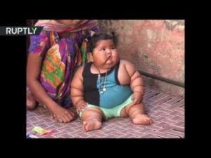 رضيعة هندية عمرها 8 أشهر تزن 17 كيلو