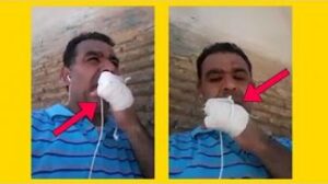 شاهد صرخة مغربي قطع له الأفارقة أصابع يده