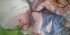 صادم:كلب ضال ينهش رأس رضيع بعدما تخلت عنه والدته قرب حاوية للقمامة