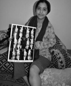 إعلان للراغبين في التضامن مع التلميذة حسناء قاسيمي في محنتها الصحية :