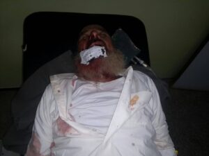 فضيحة:مؤدن مسجد يعتدي على مسن في عقده الثامن ويرسله الى المستعجلات