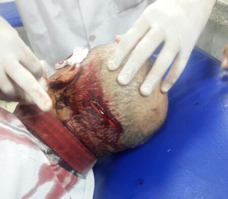 مجهولون يشرملون شخصا بأيت ملول .