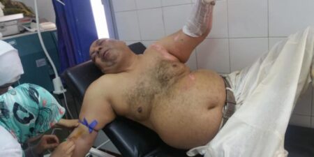 + صورة حصرية: "معمل للبيض" دفع بالبرلماني الزعيم إضرام النار في جسده