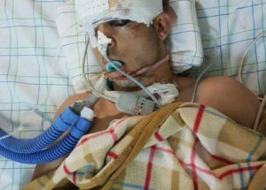 أنباء تتحدث عن وفاة أول ناشط في حراك الريف عماد العتابي والسلطات تقول أنه يوجد بالمستشفى بالرباط