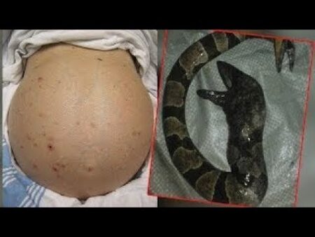سيدة أحست بألم شديد في بطنها وعند الكشف عليها كانت الصدمة !!