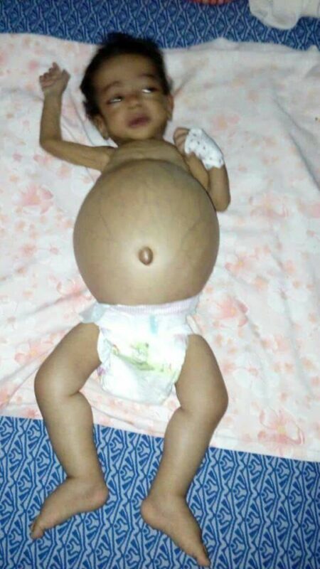 نداء إنساني عاجل من أجل إنقاد الطفلة "فاطمة الزهراء".