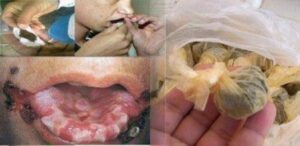 “النفحة” و “الكالا” شبحان يغزوان شوارع أكادير، و الآباء يدقون ناقوس الخطر.