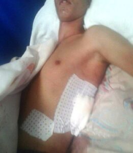 أكادير: طعنة قاتلة على مستوى الكلية بسبب فتاة، ترسل تلميذا في حالة خطيرة إلى المستعجلات (+صور).