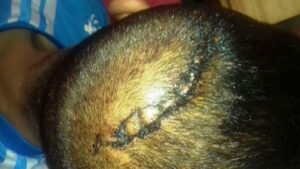 +صور مؤثرة: مواطن بأكادير ينجو من موت محقق بعد تعرضه ل”التشرميل” من طرف قاصرين بالسيوف.