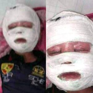 خطير: انفجار مفرقعات عاشوراء يرسل طفلا إلى المستعجلات في حالة خطيرة