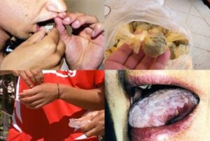 اشتوكة أيت باها: سرطان “النفحة” يغزو شوارع بيوكرى بشكل رهيب.