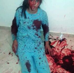 شاب يشرمل فتاة و يتسبب لها في 70 غرزة في جسدها بسبب رفضها الزواج منه