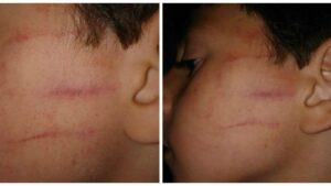 وزارة "حصاد"تكافئ استاذة صفعت تلميذا ب"التوقيف" 9 هذا ما قررته مديرية حصاد بطنجة في حق معلمة صفعت تلميذا