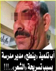 +فيديو شامل: القصة الكاملة لاعتداء أب ذي سوابق على مدير إعدادية بأكادير  بسبب “تشويكة” ابنه.‎