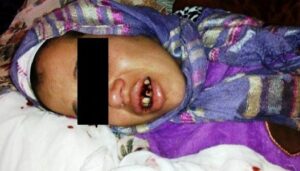 مخزني “يشرمل” زوجته عائشة بعد  رفضها منحه الموافقة على التعدد.