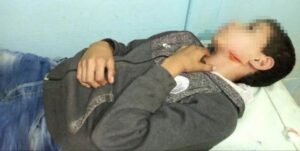 “مضاربة” بين تلميذين في الأولى اعدادي تنتهي بطعنة غادرة بسكين أحدثت جرحا غائرا على مستوى الوجه .