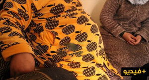 (+فيديو المرأة الحامل)أخصائي يكشف الحقيقة الكاملة للسيدة التي ادعت أنها تحمل في بطنها جنينا “حيّا” منذ 9 سنوات