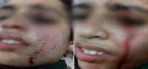 معطيات جديدة ومثيرة عن التلميذة التي شوهت وجه زميلتها ب”زيزوار”