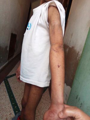 التحقيق يكشف عن معطيات جديدة في قضية الطفل المعذب على يد والدته بأكادير، والخبرة الطبية تنفي بشكل قاطع ادعاءات تعرض الطفل للتعذيب