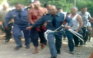 لحظات بعد آذان صلاة المغرب..مواجهة دامية بالهراوات والسيوف بين 3 أشقاء تنتهي بإصابة والدتهم بجروح خطيرة