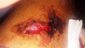 +صور: شاب يرسل قاصرا إلى قسم المستعجلات بأكادير في حالة سيئة، و أمه تطالب بالإنصاف.