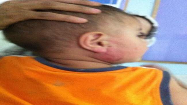 خطير:بعد رشقه بالحجارة..مختل عقليا يخطف طفلا من بين يدي والدته ويغرس أسنانه فيه.