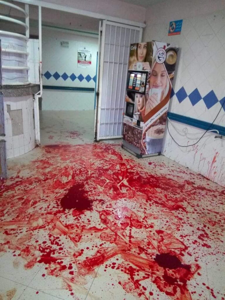 معطيات صادمة في هجوم عصابة على مستشفى إنزكان، مما يطرح على الوزارة سؤال المقاربة الأمنية الفعلية لحماية الممرضين والأطباء بهذا القسم.