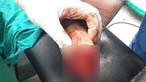 خطير بإنزكان : عصابة “جاكوار” تبتر يد ناذل مقهى بطريقة بشعة، وتلوذ بالفرار بعد سرقة أغراضه.