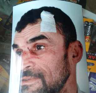 إنزكان: جانج يعرض حارس أمن لاعتداء وحشي، بعد محاولة فاشلة لاختطاف تلميذة.(صورة)