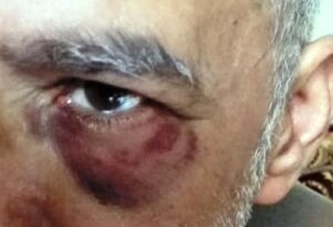 أكادير : “حارس أمن خاص” “يشرمل” مواطنا  وزوجته في عقر دراه، ويرسله إلى المستعجلات في حالة حرجة.