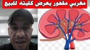 شاب مغربي يعرض كليته للبيع بسبب “ظروف قاهرة”