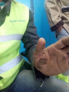 صعقة كهربائية 1