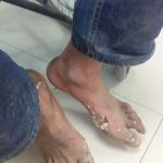 صعقة كهربائية 2