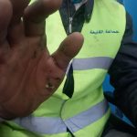 صعقة كهربائية 3