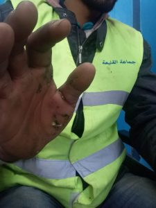 صعقة كهربائية 3