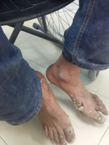 صعقة كهربائية 4