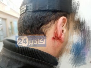 اعتداء على عون سلطة 1