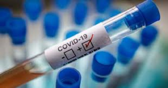 الصحة العالمية فيروس سوس ماسة كوفيد 19 تحليلات مخبرية كورونا أكادير 24