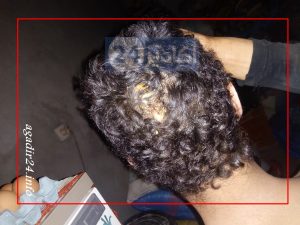 إعتداء على طفل 1