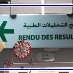 أكادير كوفيد-19 رفيروس كورونا سوس ماسة