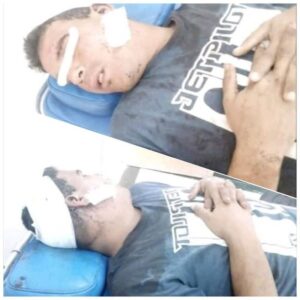 أولاد تايمة : تفاصيل توقيف "الصاروخ" المجرم الخطير الذي شرمل مواطنا وأرسله للمستشفى بين الحياة والموت 9 119858221 1689433591224643 5906805327886750592 o