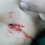 كلب ينهش طفلا بإنزكان 7