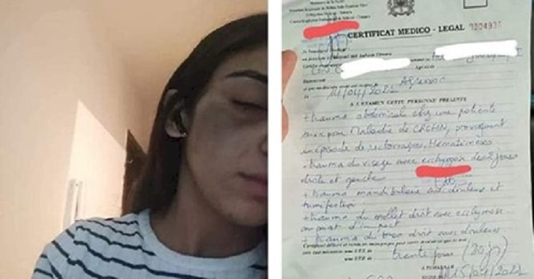 قضية الأستاذة التي اتهمت رجل أمن بالتحرش والاعتداء عليها بالشارع العام تعرف مستجدات جديدة.