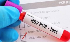 فحص PCR