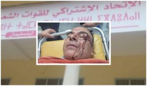 عصابة تعتدي بالسلاح الأبيض على برلماني اتحادي