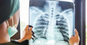 مرضى داء السل بإنزكان يعيشون الويلات.. ومصير مجهول ينتظرهم.