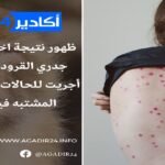 أكادير : أخ ينهي حياة أخته بشكل مروع في حادثة هي الثانية من نوعها في أقل من 24 ساعة.
