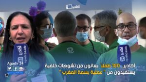 سوس ماسة.. 120 طفلاً يعانون من تشوهات خلقية يستفيدون من " عملية بسمة المغرب " 9 عملية بسمة المغرب