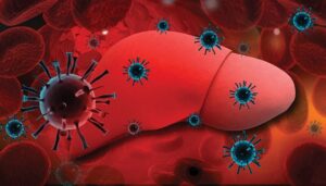 ارتفاع إصابات التهاب الكبد الفيروسي "س" يعجل باتخاذ وزارة الصحة هذا الإجراء 4 Hepatitis